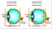 儿童近视防控“防”的是什么？孩子近视防控你真的理解吗？